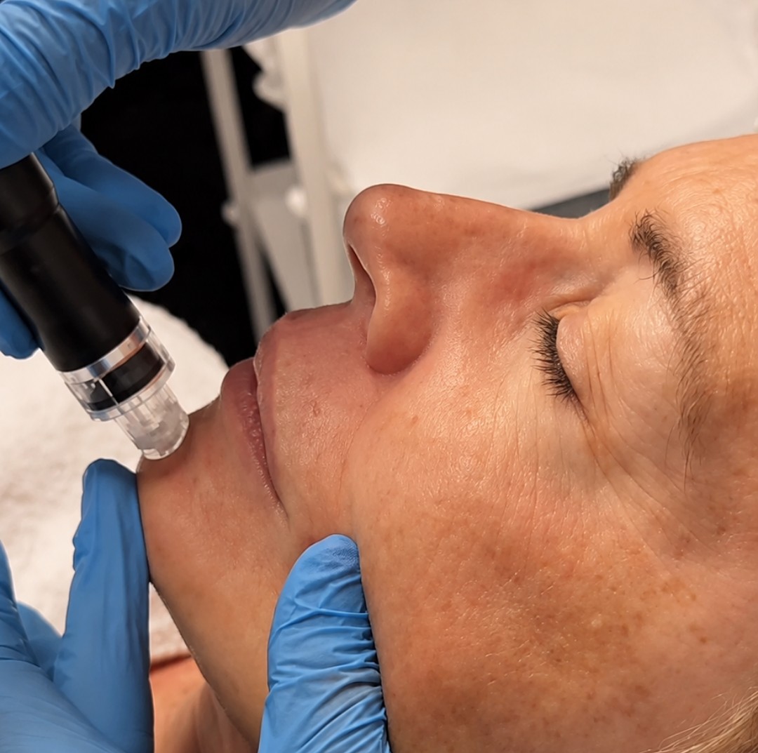Aquafacial-Behandlung: ein Handstück wird an Kinn und Wange geführt